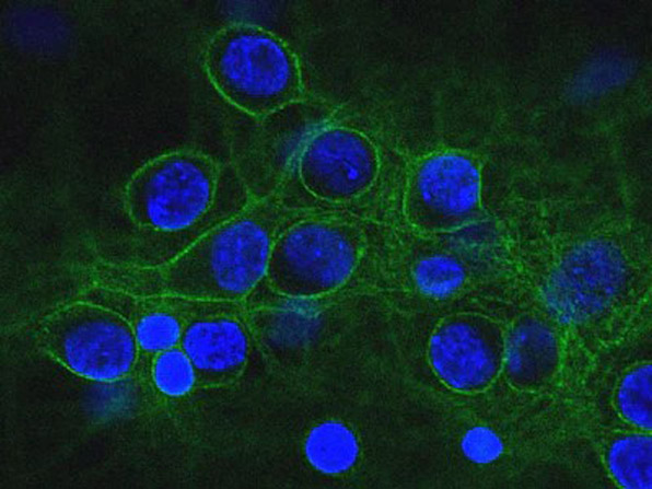 Immunofluorescence with Anti-Alpha-II-Spectrin